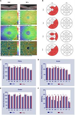 Retinal microvascular and microstructural alterations in the diagnosis of dermatomyositis: a new approach